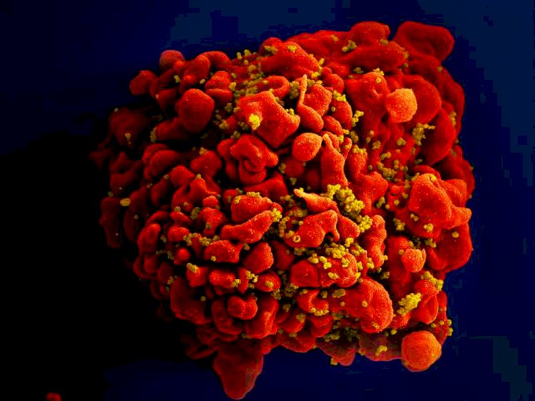 O que é a remissão do HIV e por que é tão difícil se curar do vírus?