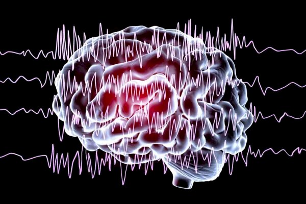 Cientistas apontam novo sintoma grave que pode surgir após Covid