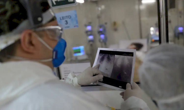 Covid é principal causa de internação por síndrome respiratória no Rio